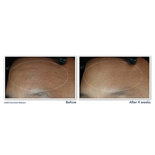 RoC Retinol Correxion Max Crema de hidratación diaria antienvejecimiento para hidratación profunda de 24 horas, humectante antiarrugas avanzado fabricado con retinol y