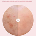 Parche Blemishield por Glam Up