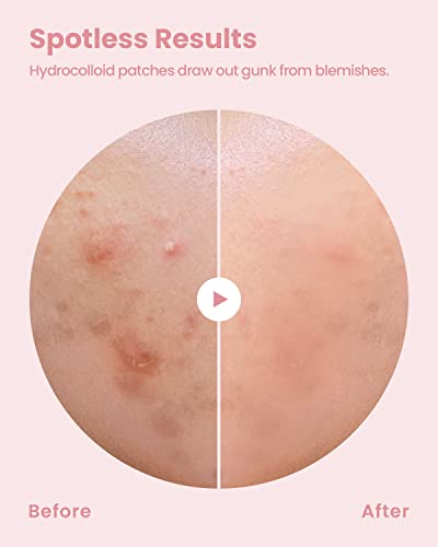 Parche Blemishield por Glam Up