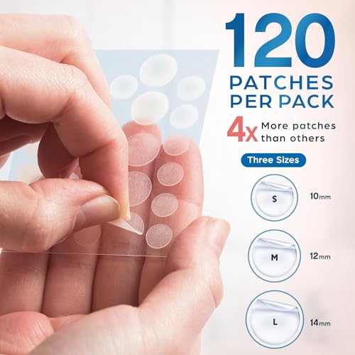KEYCONCEPTS Parches de espinillas, parches de acné hidrocoloide con aceite de árbol de té, parches de espinillas para cara, parches de espinillas y calcomanías de espinillas, puntos de acné hidrocoloide para curar el acné con parches de picazón