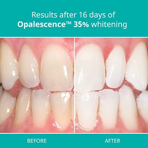 OPALESCENCE 35% MINT TEETH TOOTH WHITENING GEL 4SY by ULTRADENT
