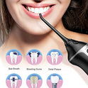 Nicefeel - Depósito de agua limpiable de 300 ml, recargable, 3 modos, irrigador oral con funda de punta para cuidado bucal