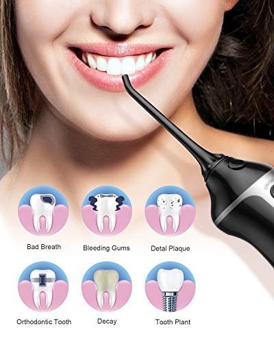 Nicefeel - Depósito de agua limpiable de 300 ml, recargable, 3 modos, irrigador oral con funda de punta para cuidado bucal