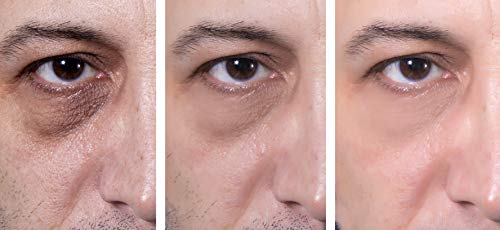 Eye Gel, for Dark Circles, Puffiness, Wrinkles, Skin Firming and Bags - Effective Anti-Aging Eye Gel for Under and Around Eyes including Crows Feet wi