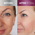 Retinol Vitamin A Eye Gel – Anti-Wrinkle Treatment Minimizes Signs of Aging, Puffiness & Dark Circles Around Eyes – Extra Boost of Retinol From Micro-Beads Restores Tone & Elasticity to Eye Area