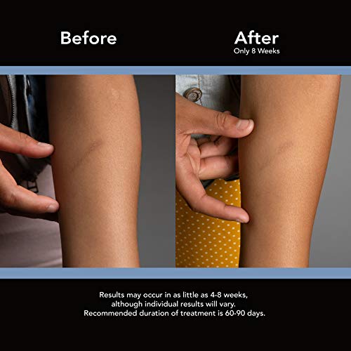 ScarAway Silicone Scar Sheets (1.5" x 3") 8 ct
