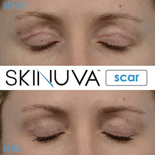 Skinuva - Crema para cicatrices de última generación, crema avanzada para eliminar cicatrices formulada con factores de crecimiento. (50,27 ml)
