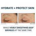RoC Corrección profunda de arrugas con retinol, 29.6 ml (1oz)