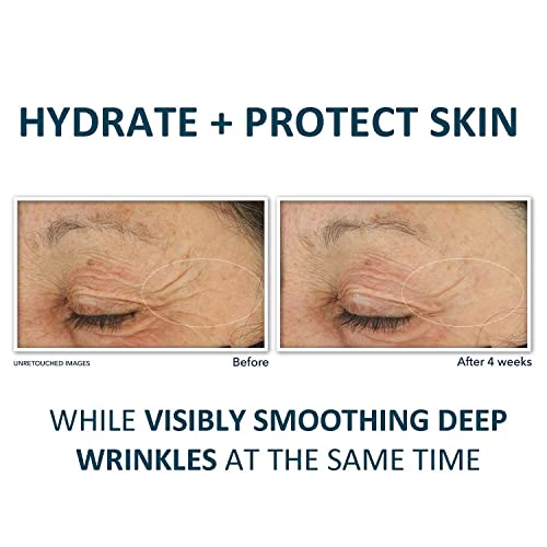 RoC Corrección profunda de arrugas con retinol, 29.6 ml (1oz)