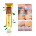 Scar Removal Cream For Old Scars- Stretch Mark Removal Cream for Men & Women- Stretch Marks Relief and Burns Repair,Face Skin Repair Cream