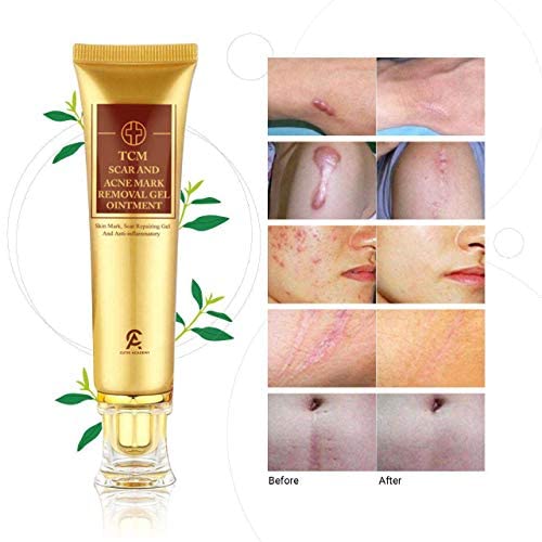 Scar Removal Cream For Old Scars- Stretch Mark Removal Cream for Men & Women- Stretch Marks Relief and Burns Repair,Face Skin Repair Cream