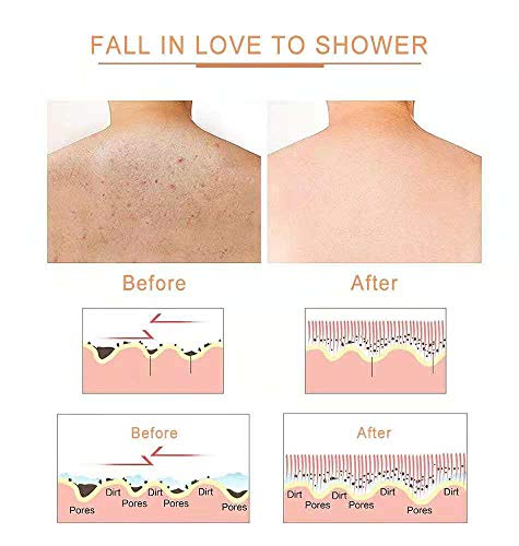 Dry Brushing Body Brush, Dry Brush Natural Bristle Removable Long Handle Antiskid Rope Dry Brush Skin Remove Dead Skin And Toxins, Cellulite Treatment