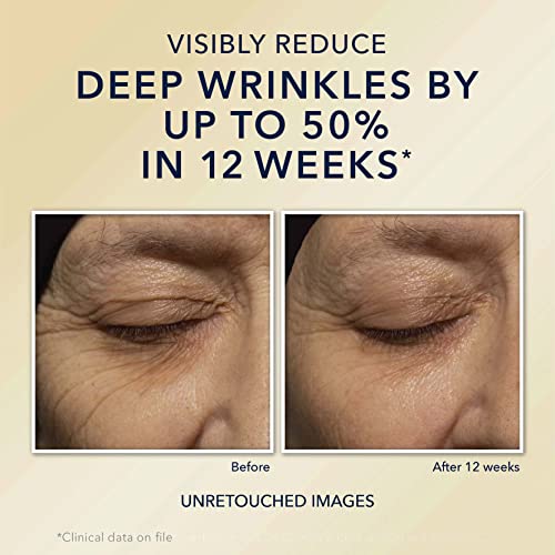 RoC Retinol Correxion Deep Wrinkle Night Cream, 1 Ounce