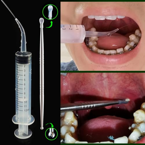 Airgoesin Herramienta profesional de eliminación de piedras de amígdalas con luz LED | Púa de tonsilolito de acero inoxidable | Jeringa de riego | Rascador limpiador de lengua