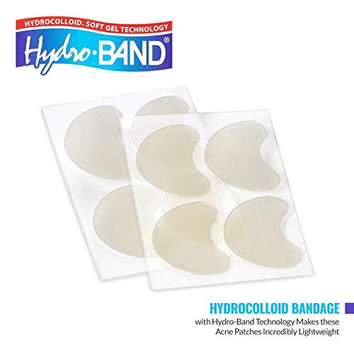 Acne Patch - Pimple Spot Treatment Hydrocolloid Bandages Absorbing Zit Cover Dots, Heart and Star Shapes by MEDca