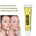 1pcs/Lot Chinese Herbal Eczema, Psoriasis Creams Dermatitis and Eczema Pruritus Psoriasis Ointment