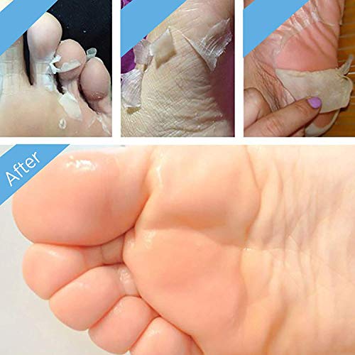 2 Pairs Foot Peel Mask Exfoliant for Soft Feet in 1-2 Weeks, Exfoliating Booties for Peeling Off Calluses & Dead Skin, For Men & Women Lavender by Bea Luz