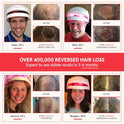 iRestore Laser Hair Growth System - FDA-Cleared Hair Loss Treatment & Treats Balding, Thinning Hair for Men and Women - Laser Hair Restoration Therapy Improves Hair Thickness, Volume, and Density by iRestore