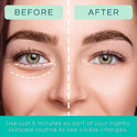 Patchology Parches de gel para restaurar la noche y el día bajo los ojos