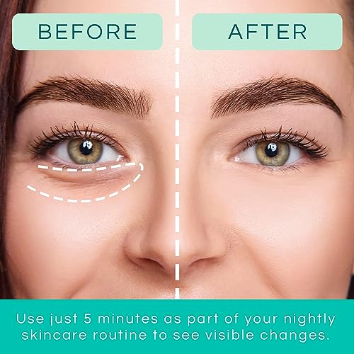 Patchology Parches de gel para restaurar la noche y el día bajo los ojos