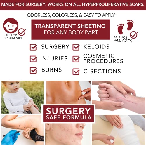 Physician Formulated Silicone Scar Gel - Advanced Crosspolymer Medical Grade Scar Cream for Face, Body, Surgery, C Section, Burn, Keloids & Hypertrophic Scars by Makers of HealFast Surgery Recovery