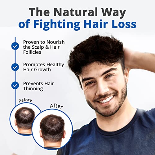HAIRMETTO Saw Palmetto Stinging Nettle SERUM for Hair Growth, Hair Regrowth, Alopecia, Hair Loss, Baldness Treatment, DHT Blocker, Androgen Blocker, Hair Follicle Stimulator Oil for Hair Regeneration