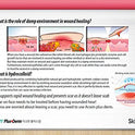 Acwin Plus Derm 3 Pack Acne Spot Pimple Absorbing Cover Patch, Moist Wound Dressing for Skin Trouble Acne Pimple Care Hydrocolloid Patch (Total 204 count)