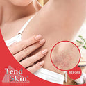 TEND SKIN Skin Care Solution Refillable Roll On 2.5oz