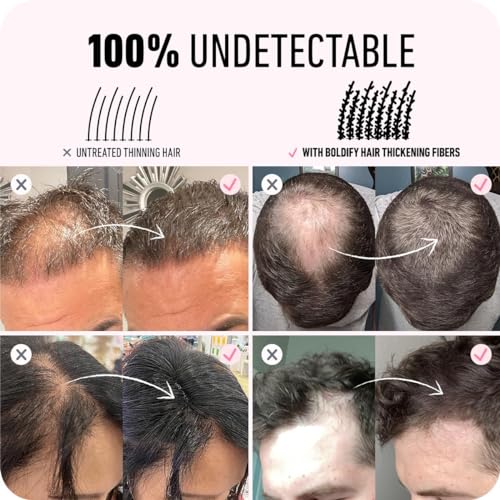 BOLDIFY Fibras Capilares para Cabello Fino Polvo Pelo Hombre – Botella – Relleno Natural, Oculta al Instante la Pérdida de Cabello – Fibra Capilar Hombre, Mujer