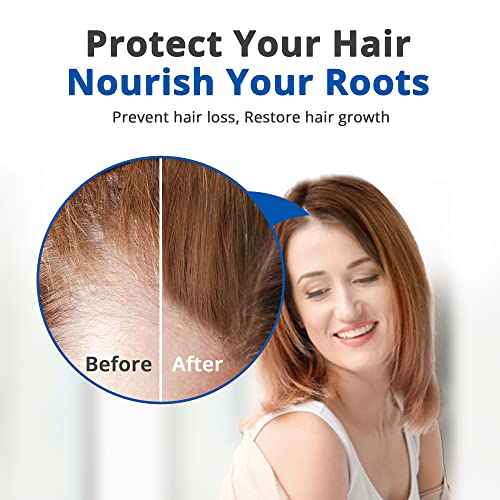 HAIRMETTO Saw Palmetto Stinging Nettle SERUM for Hair Growth, Hair Regrowth, Alopecia, Hair Loss, Baldness Treatment, DHT Blocker, Androgen Blocker, Hair Follicle Stimulator Oil for Hair Regeneration
