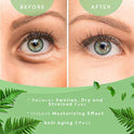 Parches de gel para ojos de té verde, parches de gel para ojos de té verde, máscaras para ojeras y hinchazón, máscara de colágeno para ojos debajo de los ojos, máscara de gel para ojos hinchados, ojeras, tratamiento de ojos para mujeres