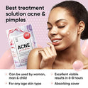 Acne Pimple Master Patch 36 dots - Absorbing Hydrocolloid Blemish Spot Skin Treatment and Care Dressing