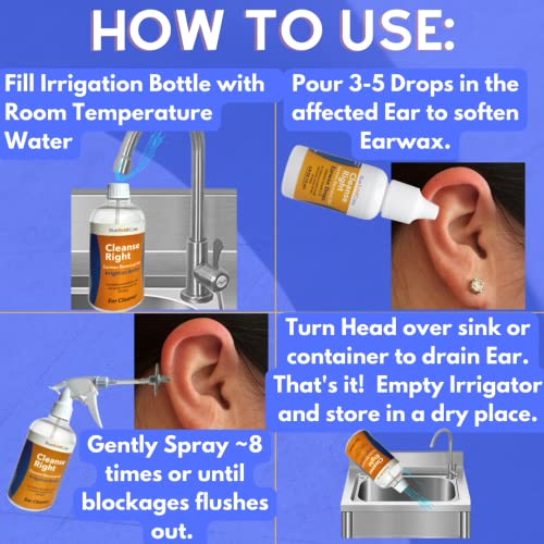 Cleanse Right Ear Wax Removal Kit- 20 Disposable Tips! with Wash Basin and Syringe - Safe, Easy to Use - Cleaner Tool to Remove Ear Blockage - Irrigation Device for Adults and Kids