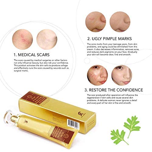 Scar Removal Cream For Old Scars- Stretch Mark Removal Cream for Men & Women- Stretch Marks Relief and Burns Repair,Face Skin Repair Cream
