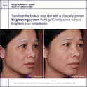 Obagi Nu-Derm Fx System - Kit de secado normal