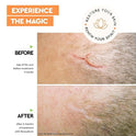 Strataderm Gel for Professional Scar Therapy 20g / 0.7oz