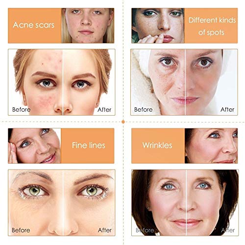 Suero natural de ácido hialurónico de vitamina C para cuidado facial hidratante+antiarrugas+antienvejecimiento+disminuir las líneas finas del cuello (30 ml)