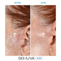 Skinuva - Crema para cicatrices de última generación, crema avanzada para eliminar cicatrices formulada con factores de crecimiento. (50,27 ml)