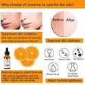 Suero natural de ácido hialurónico de vitamina C para cuidado facial hidratante+antiarrugas+antienvejecimiento+disminuir las líneas finas del cuello (30 ml)