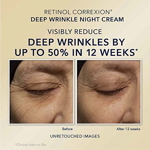 RoC Retinol Correxion - Paquete de reparación de arrugas profundas