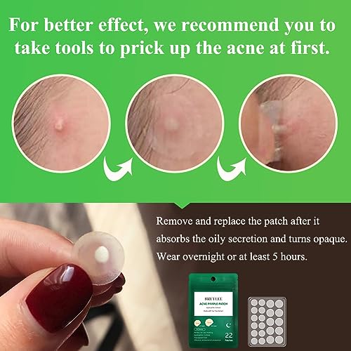 BREYLEE Acne Pimple Patch, Pimple Patch Acne Pimple Healing Patch Series