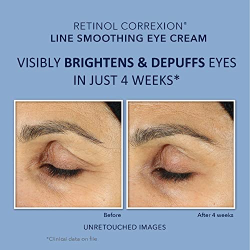 RoC Retinol Correxion - Paquete de reparación de arrugas profundas