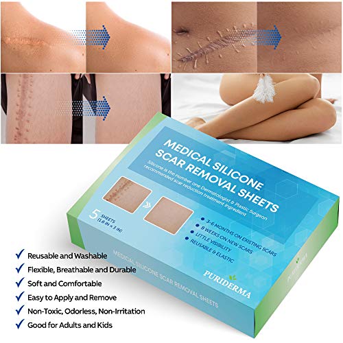 Puriderma Medical - Hojas de silicona para eliminar cicatrices (5 unidades) – Rápido y eficaz en queloides, cirugía, quemaduras, acné, cicatrices de sección C