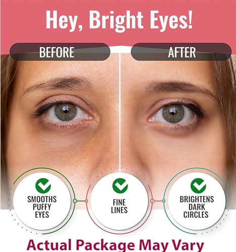 Look At Me Hydrating Hydro-gel Eye Patches, Green Tea |Pack of 2