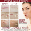 Physician Formulated Silicone Scar Gel - Advanced Crosspolymer Medical Grade Scar Cream for Face, Body, Surgery, C Section, Burn, Keloids & Hypertrophic Scars by Makers of HealFast Surgery Recovery