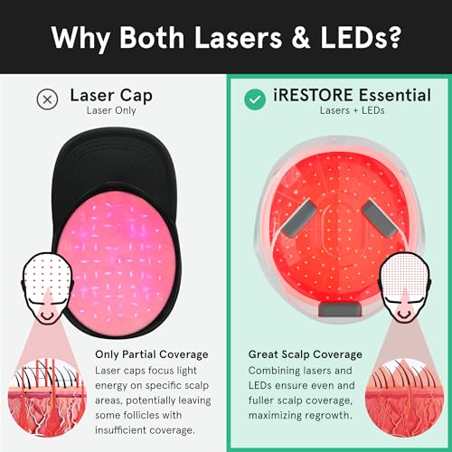iRestore Laser Hair Growth System - FDA-Cleared Hair Loss Treatment & Treats Balding, Thinning Hair for Men and Women - Laser Hair Restoration Therapy Improves Hair Thickness, Volume, and Density by iRestore