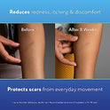 ScarAway Scaraway Active - Spray de silicona para cicatrices