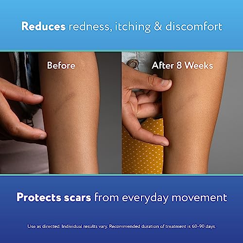 ScarAway Scaraway Active - Spray de silicona para cicatrices