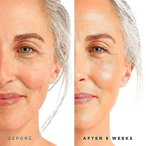 ToLB Retinol Serum - 72% Organic - Clinical Strength Retinol Moisturizer - Anti Aging Anti Wrinkle Facial Serum - 1 ounce