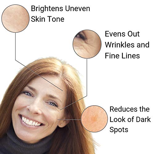 Kiss Uneven Skin Tone Goodbye! Organys 20% Vitamin C Serum w/Hyaluronic & Ferulic Acid For Bright Glowing Skin. Targets Face Eye Wrinkles Dark Sun Age Spots Pores Acne Scars With Anti Aging Benefits
